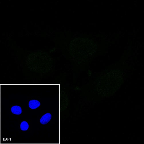 E-Cadherin Recombinant Rabbit mAb (FITC Conjugate) (S-438-5)
