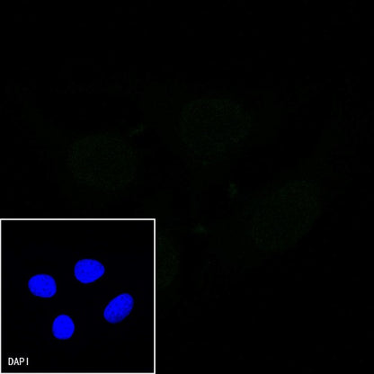 E-Cadherin Recombinant Rabbit mAb (FITC Conjugate) (S-438-5)