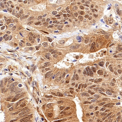 BAG3 Recombinant Rabbit mAb (S-1837-22)