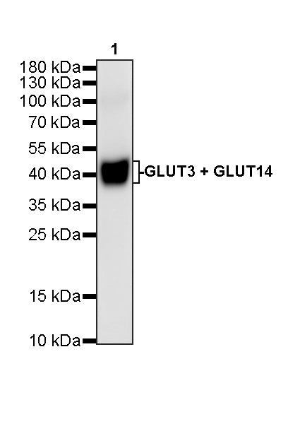 GLUT3 + GLUT14 Recombinant Rabbit mAb (S-5945)