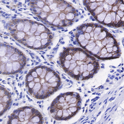 CD49b / Integrin alpha 2 Recombinant Rabbit mAb (SDT-399-52)
