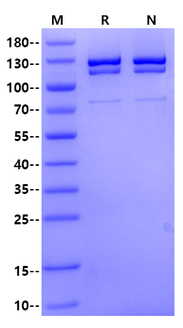 PARG His tag Protein, Mouse
