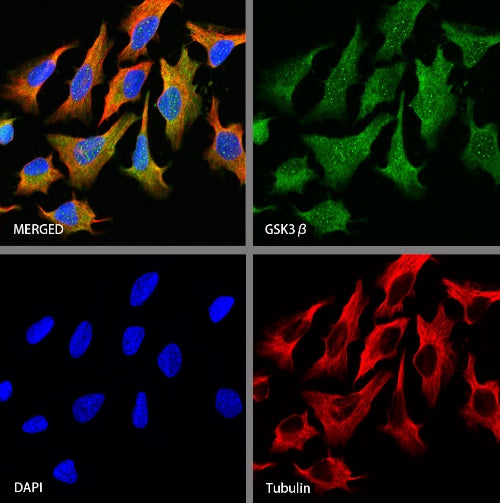 GSK3β Recombinant Rabbit mAb (S-1209-170)