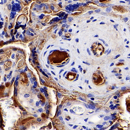 TRF Recombinant Rabbit mAb (S-613-85)