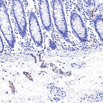 Nestin Recombinant Rabbit mAb,PBS Only (SDT-R112)