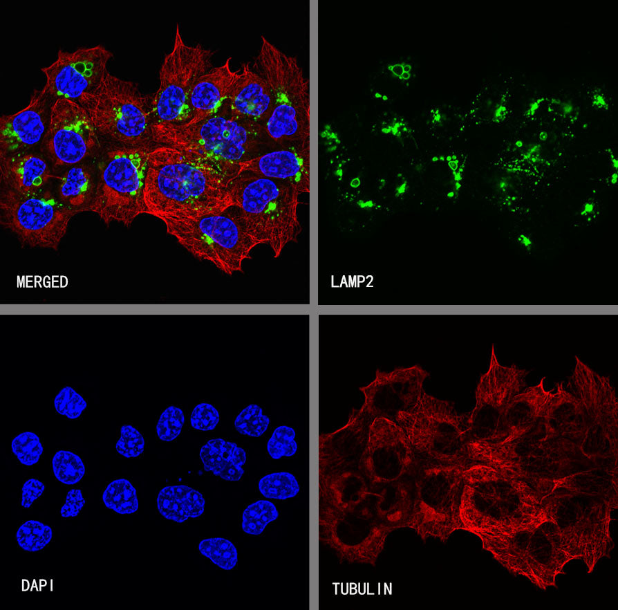 LAMP2 Rabbit Polyclonal Antibody