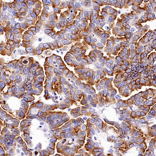 Beta II tubulin Recombinant Rabbit mAb (S-1055-2)