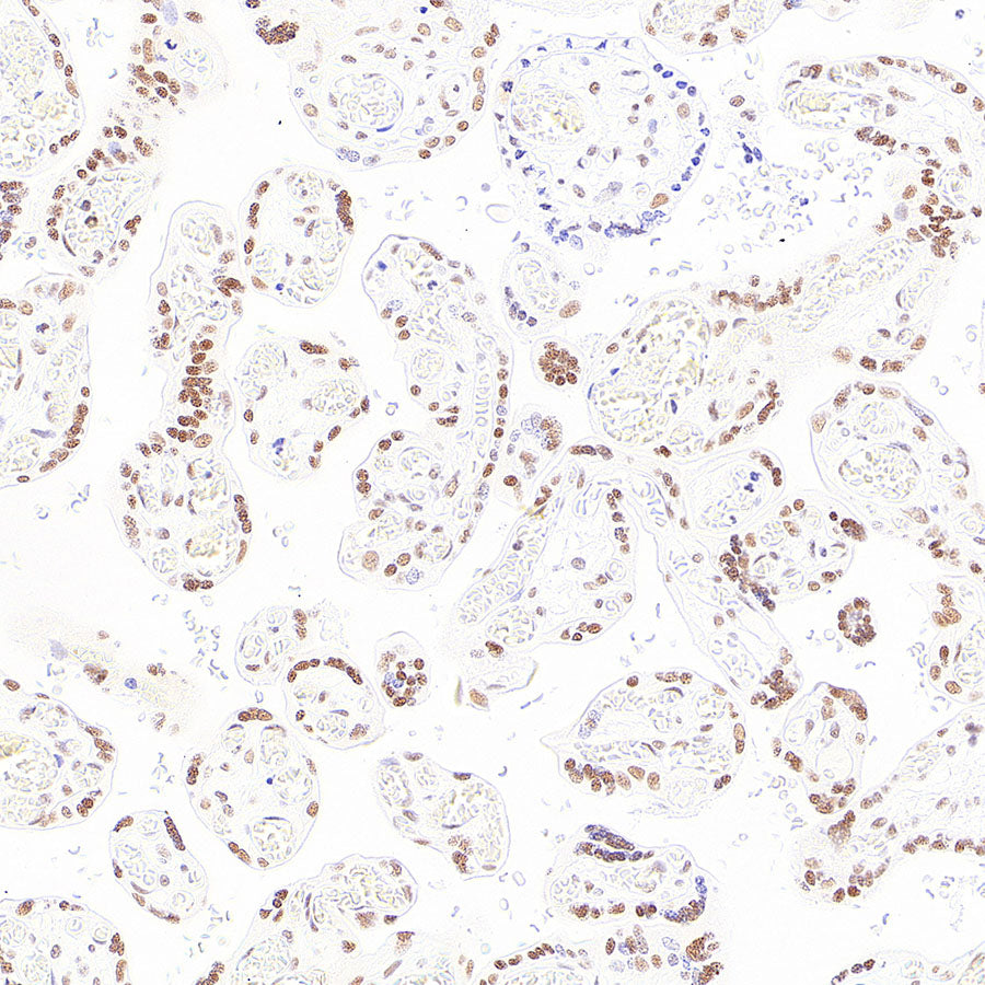 RAD21 Recombinant Rabbit mAb (S-4271-136)