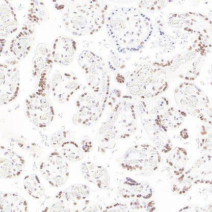 RAD21 Recombinant Rabbit mAb (S-4271-136)