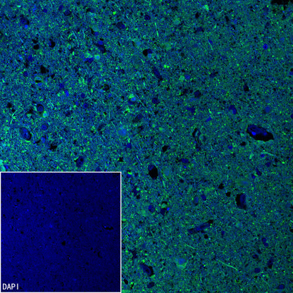 PGP9.5 Recombinant Mouse mAb (S-6071)