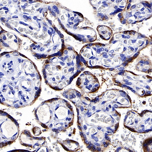 cGAS Recombinant Rabbit mAb (S-708-15)