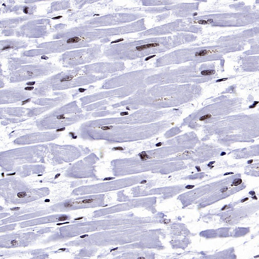 NRF1 Recombinant Rabbit mAb (S-2409-103)