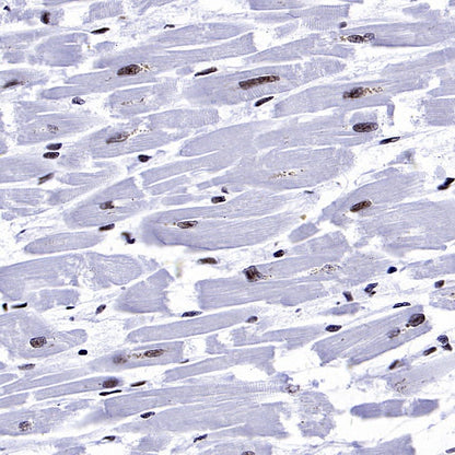 NRF1 Recombinant Rabbit mAb (S-2409-103)