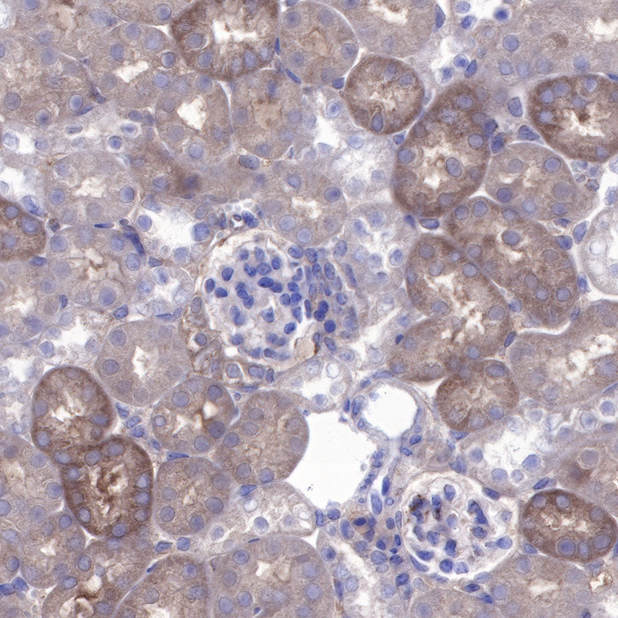 BAX Recombinant Rabbit mAb (SDT-338-76)