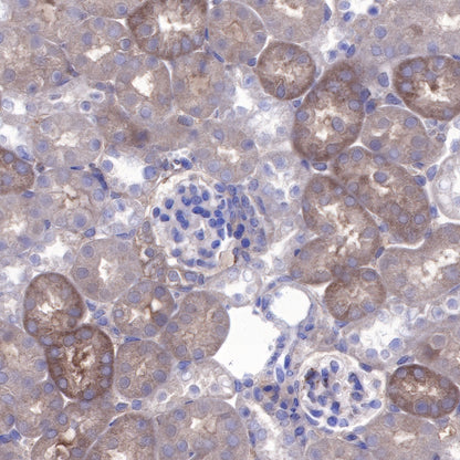BAX Recombinant Rabbit mAb (SDT-338-76)