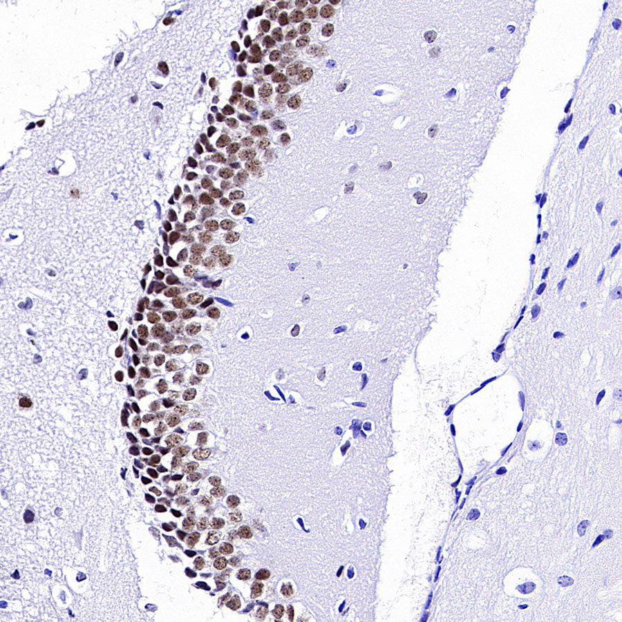 FOXG1 Recombinant Rabbit mAb (S-5244)