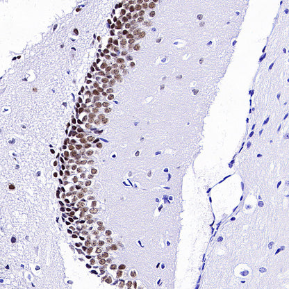 FOXG1 Recombinant Rabbit mAb (S-5244)