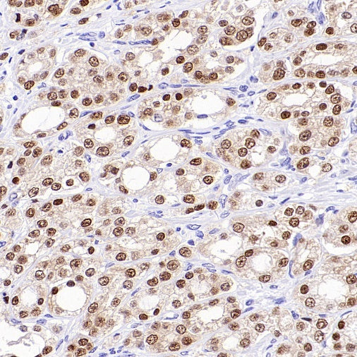 NKX3.1 Recombinant Rabbit mAb (S-2778-63)