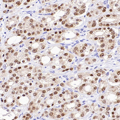 NKX3.1 Recombinant Rabbit mAb (S-2778-63)