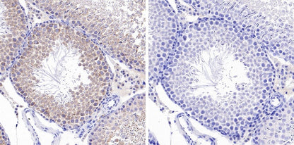 Phospho-GCN2 (T899) Recombinant Rabbit mAb (S-1665-19)