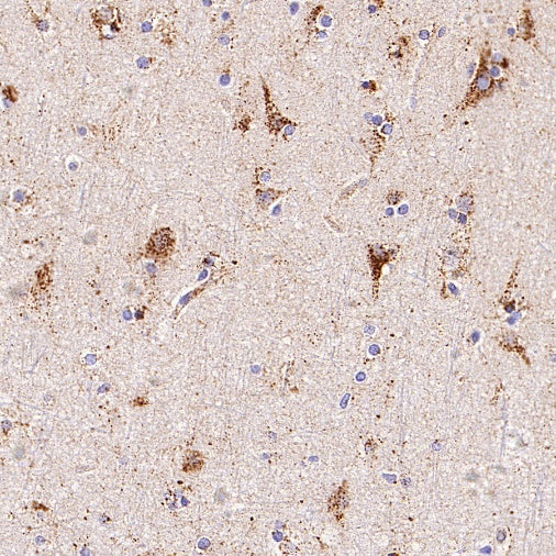 GBA Recombinant Rabbit mAb (S-3211-14)