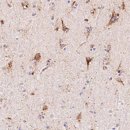 GBA Recombinant Rabbit mAb (S-3211-14)