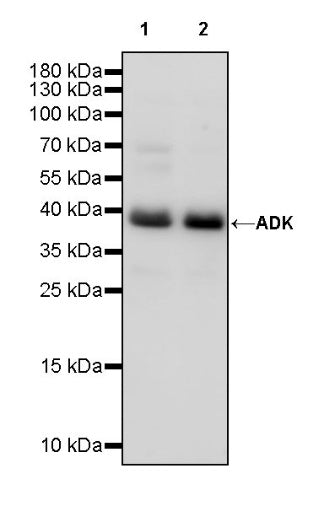 ADK Rabbit Polyclonal Antibody
