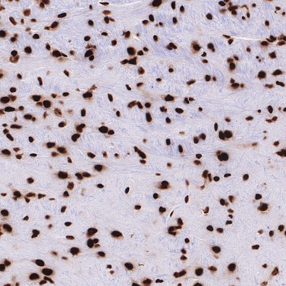 TDP43 Recombinant Rabbit mAb (S-R354)
