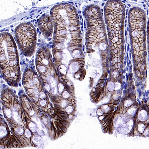 TROP1/EPCAM Recombinant Rabbit mAb (S-1379-5)