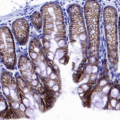 TROP1/EPCAM Recombinant Rabbit mAb (S-1379-5)