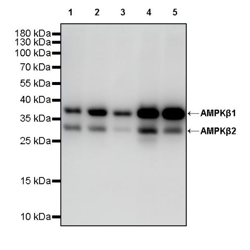 AMPKβ1/2 Recombinant Rabbit mAb (S-2728-26)