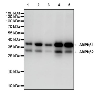 AMPKβ1/2 Recombinant Rabbit mAb (S-2728-26)