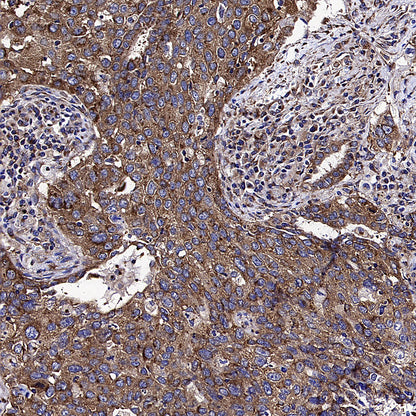 PUMA Recombinant Rabbit mAb