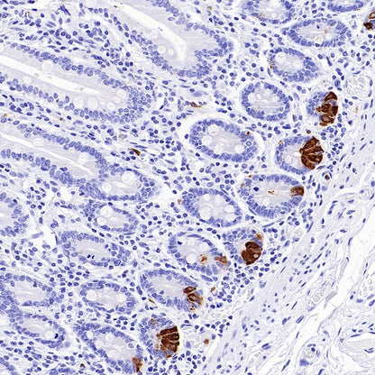 Lysozyme Rabbit Polyclonal Antibody