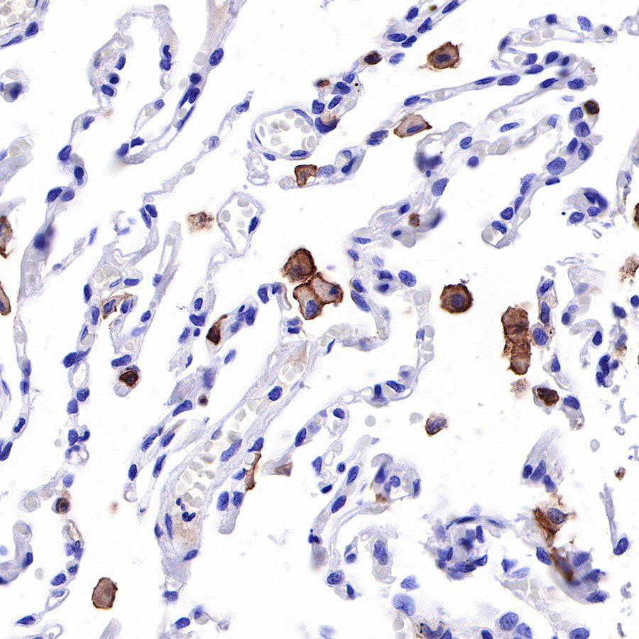 S-RMab® CD16a Recombinant Rabbit mAb,PBS Only (SDT-366-45)