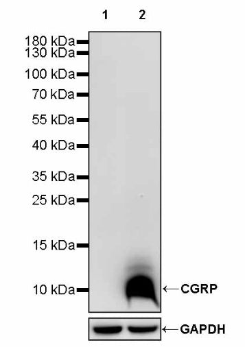 CGRP Recombinant Rabbit mAb (S-2490-74)