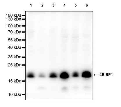 4E-BP1 Recombinant Rabbit mAb (S-1654-47)