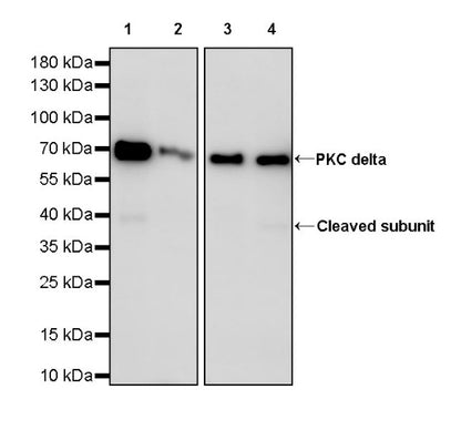 PKC delta Recombinant Rabbit mAb (S-2611-39)
