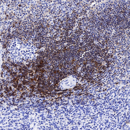 CCR7 Recombinant Rabbit mAb (S-999-29)