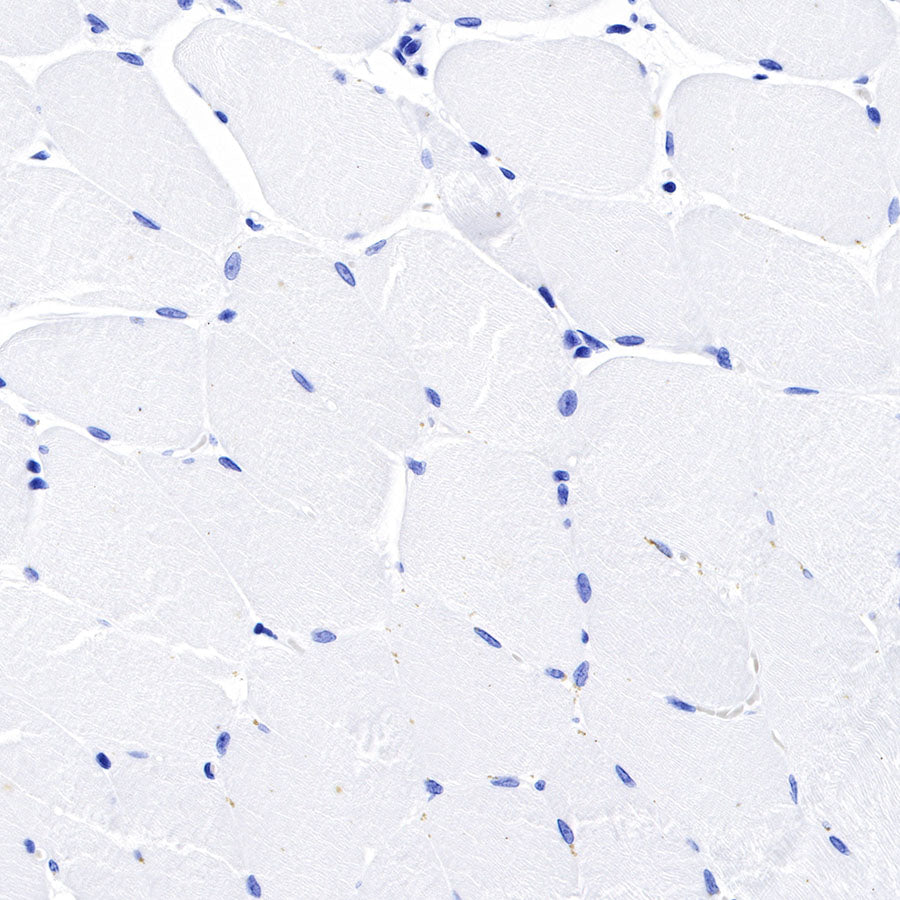 S-RMab® Mesothelin Recombinant Rabbit mAb (SDT-R070)