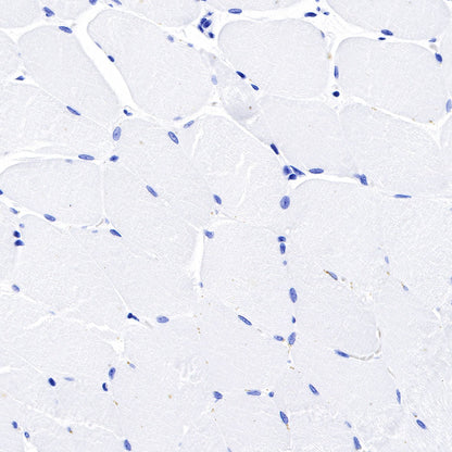 S-RMab® Mesothelin Recombinant Rabbit mAb (SDT-R070)