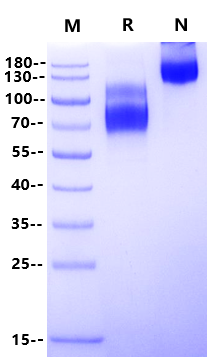 IL-17 RA&IL-17 RC Heterodimer His&Tag Free Protein, Human