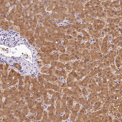 Prohibitin Recombinant Rabbit mAb (S-2679-7)