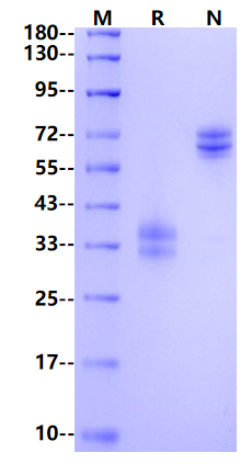 Adrenomedullin/ADM Fc Chimera Protein, Human