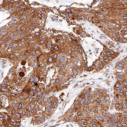 SERCA2 ATPase Recombinant Rabbit mAb (S-5956)