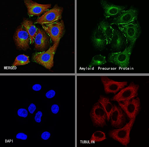Amyloid Precursor Protein Recombinant Rabbit mAb (S-806-13)
