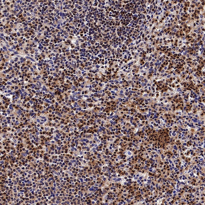 Stat5 Recombinant Rabbit mAb (S-2823-24)