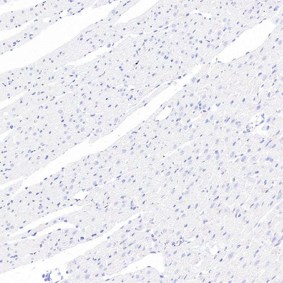 H+/K+-ATPase Recombinant Rabbit mAb (S-3474-110)