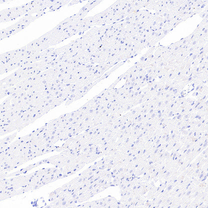 H+/K+-ATPase Recombinant Rabbit mAb (S-3474-110)