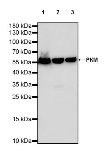 PKM Recombinant Rabbit mAb (S-812-20)